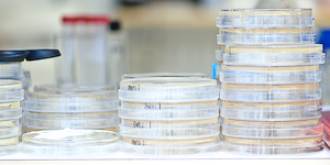 http://www.mikrobiologi.net/varmote/files/Disks%20(1%20of%201).jpg