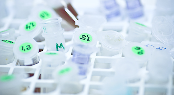 http://www.mikrobiologi.net/varmote/files/Tubes%20(1%20of%201)-2.jpg